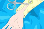 骨折した腕にプレートをはめる手術をするゲーム：OPERATE NOW: ARM SURGERY 2